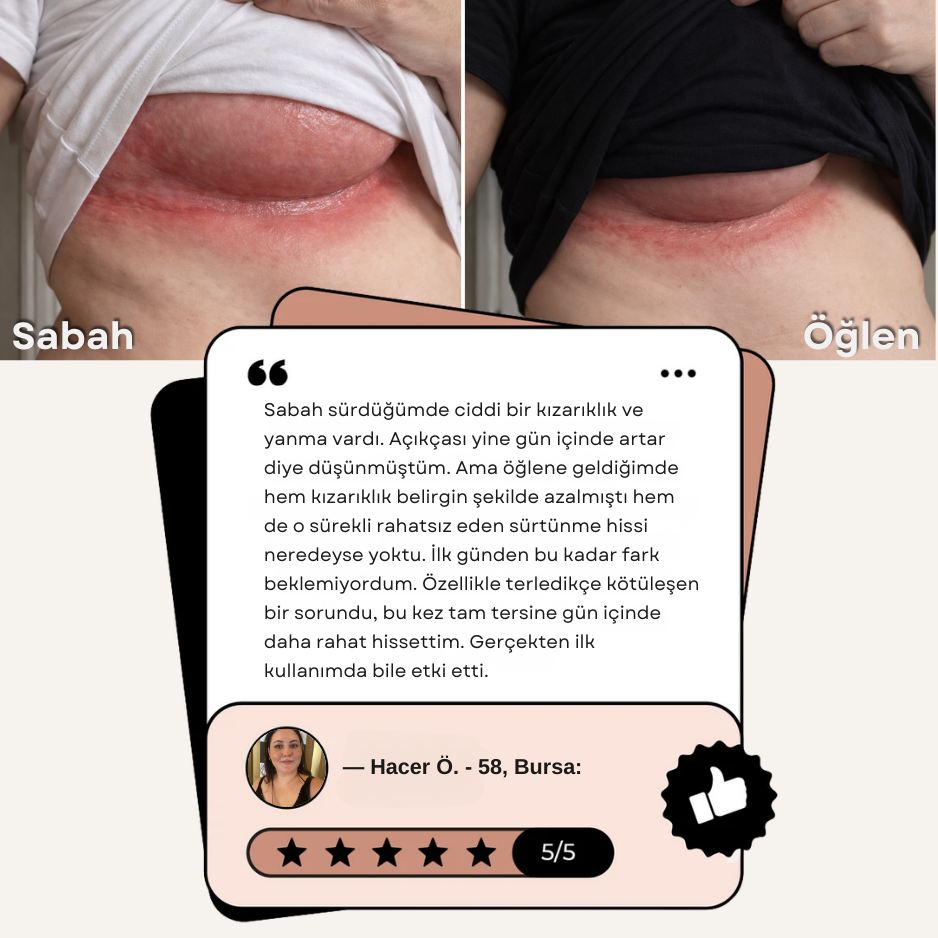 Glimera Meme Altı Tahriş ve Pişik Bakım Kremi